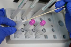 Schimmel Tupferprobe